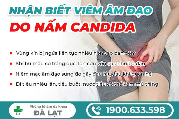 Hình ảnh minh họa